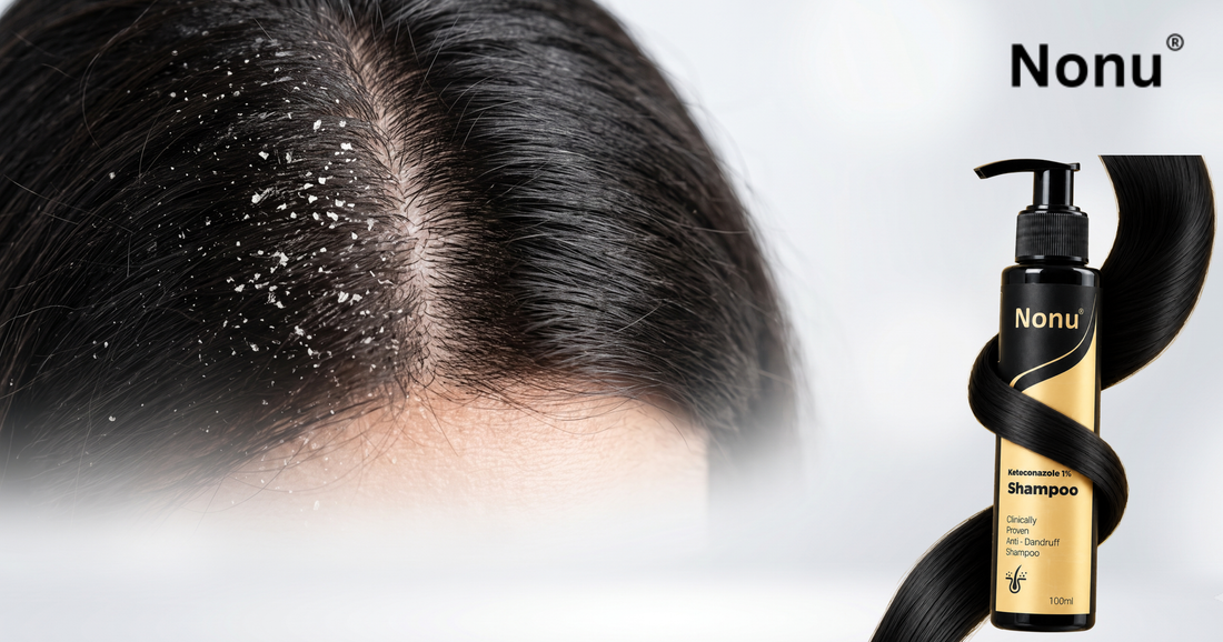 No More Flakes: Best Anti-Dandruff Shampoo for All Hair Types