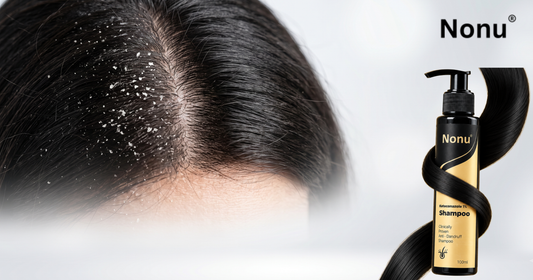 No More Flakes: Best Anti-Dandruff Shampoo for All Hair Types