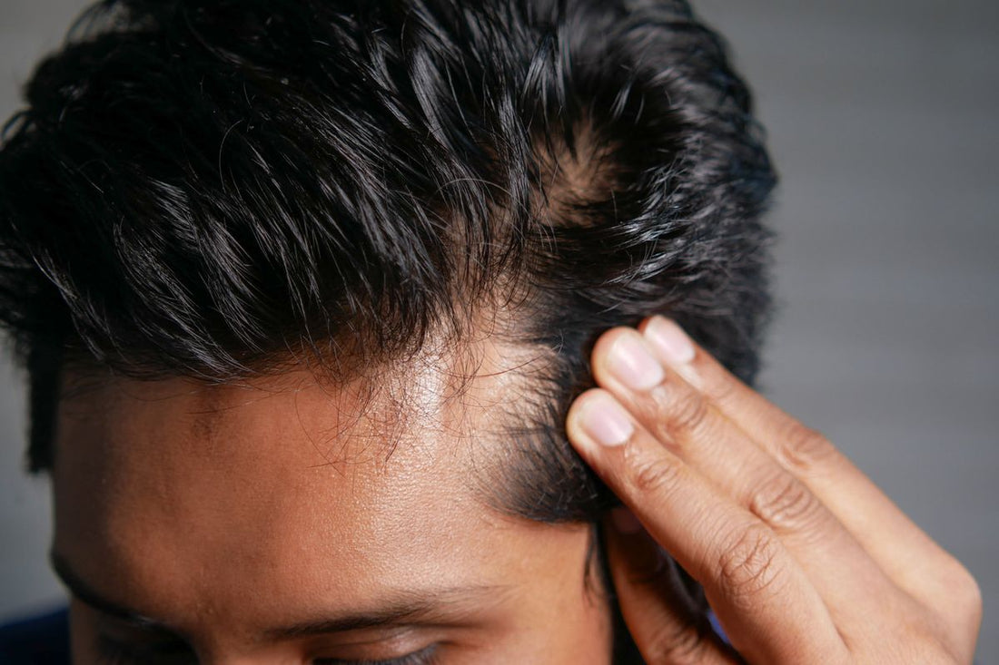 Does Finasteride Work for Hair Loss? Benefits & Side Effects