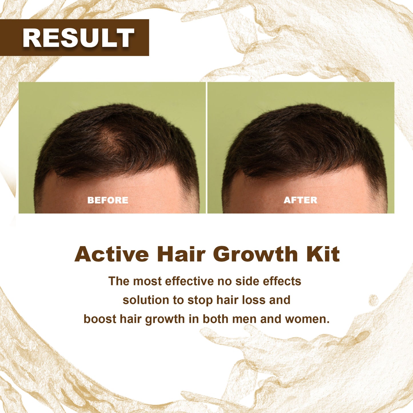 Active Hair Growth Kit | 100% Natural Solution for General Hair Care