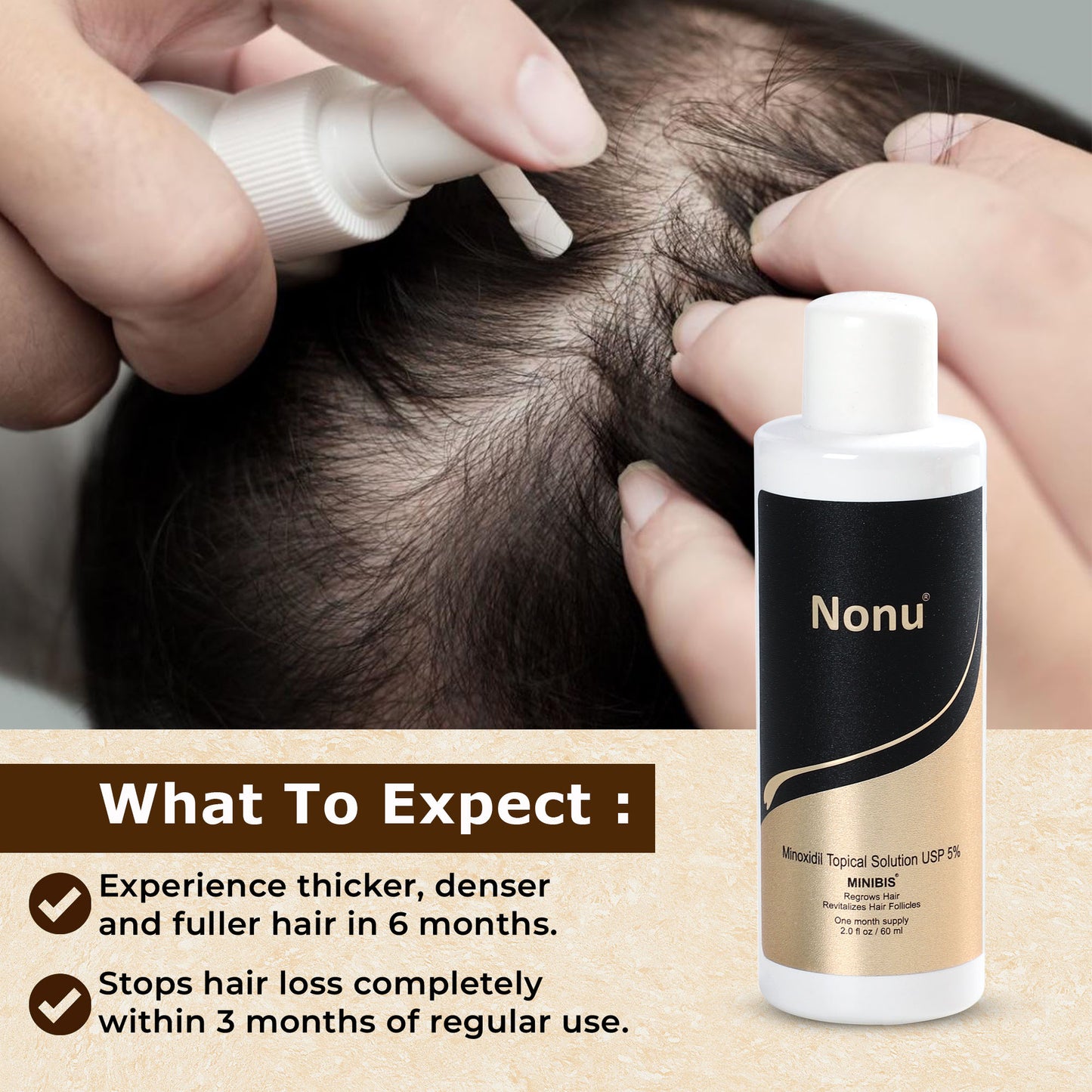 Minoxidil 5% | Alcohol Free with 2x Penetration Rate